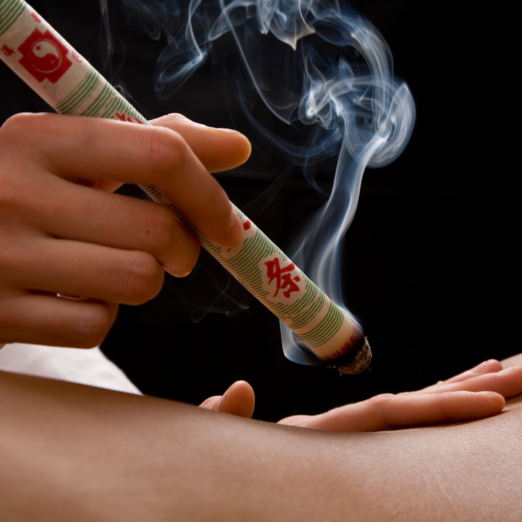 Moxa Moxibustion